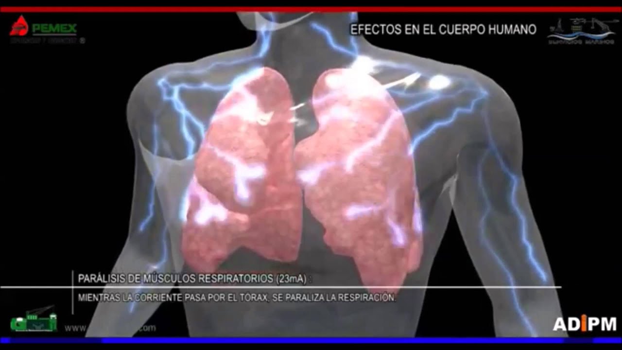 consecuencias de la falta de energia electrica